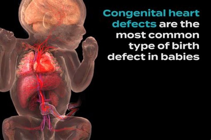 Discoveries And Insights For Congenital Heart Defects