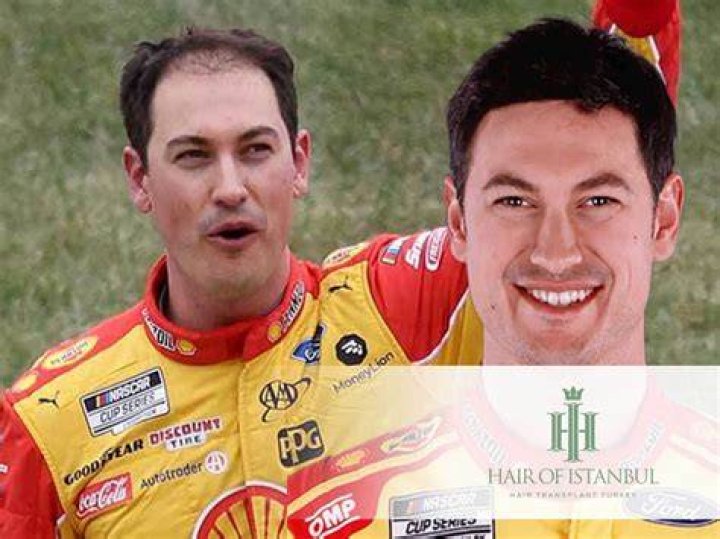 Joey Logano Hair Club