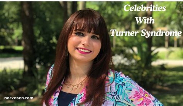Unveiling The Extraordinary: Actors With Turner Syndrome
